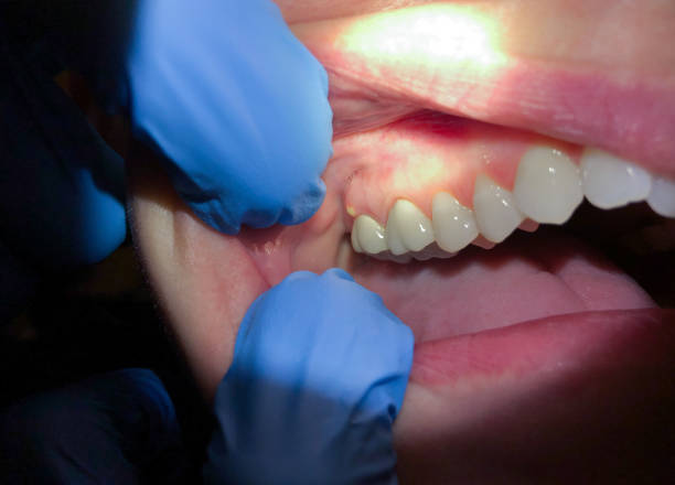 Best Weekend Emergency Dental Services in Shady Spring, WV