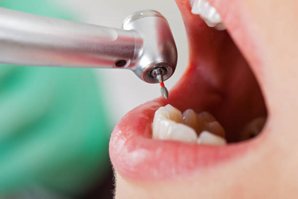 Best Emergency Treatment for Oral Infections in Shady Spring, WV